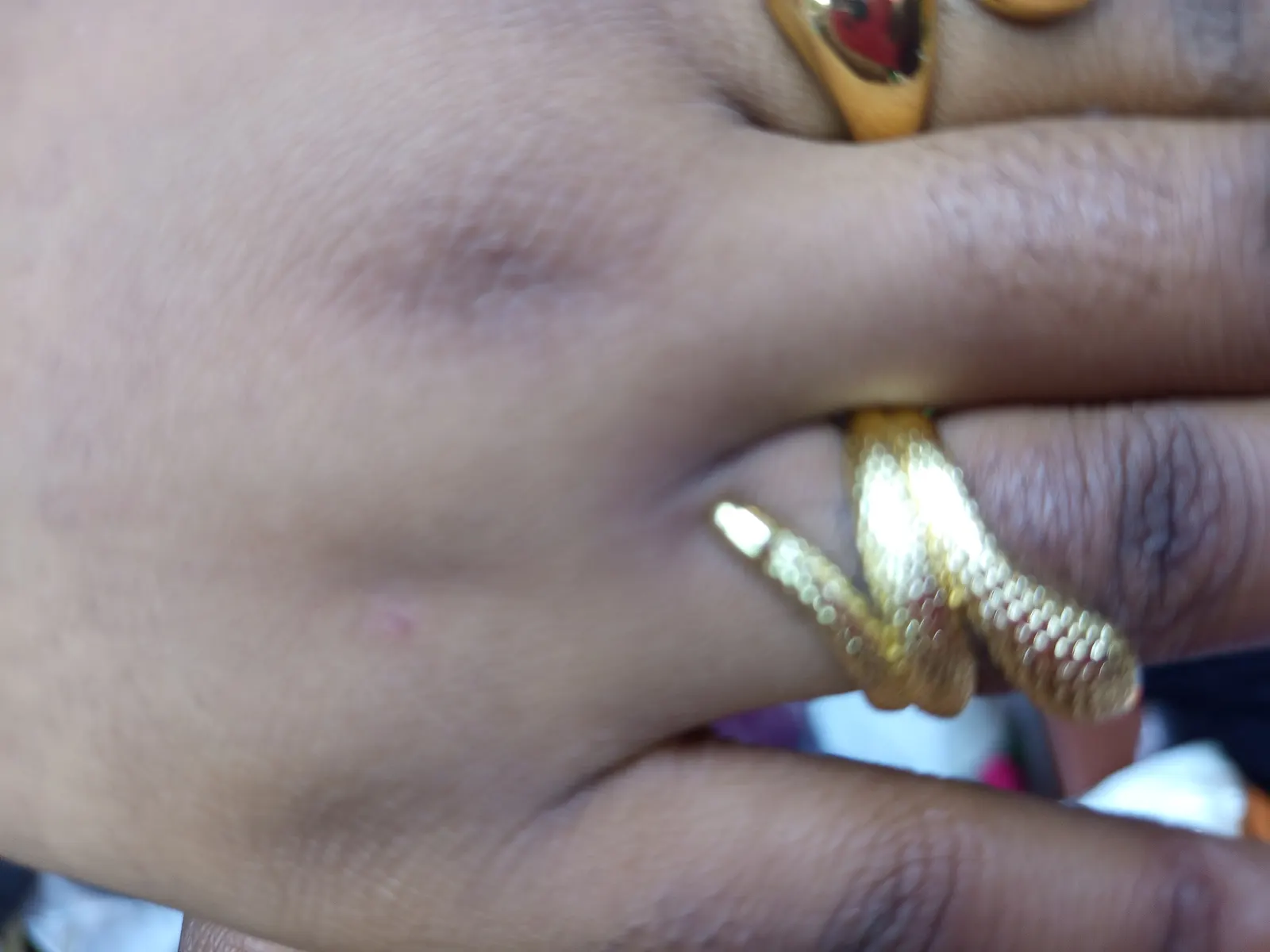 Rings 2